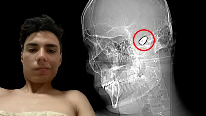 Kafasında Patlamaya Hazır Bomba Taşıyan Genç Kızın Hikayesi