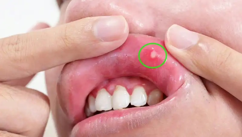 Vücudunuzda B vitamini eksikliği mi var? İşte Dikkat Etmeniz Gereken Beş Belirti!