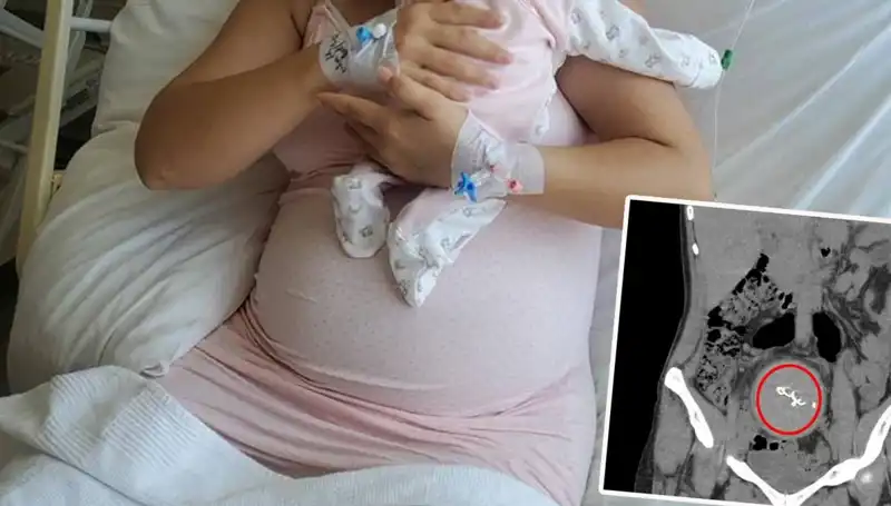 Doğumda Unutulan Bebeğin Şaşırtıcı Hikayesi ve Gazlı Bez İhmaline Soruşturma