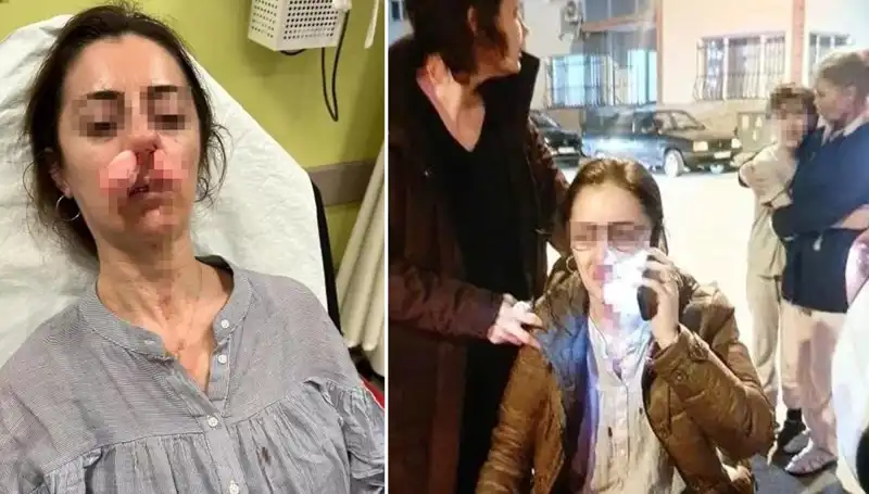 Eşinin Sevgilisi Sandığı Adam Araba Kapısıyla Saldırdı!