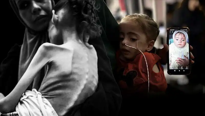 Küçük Meryem’in Açlıkla Mücadelesi: 25 Kilodan 10 Kiloya Düştü!