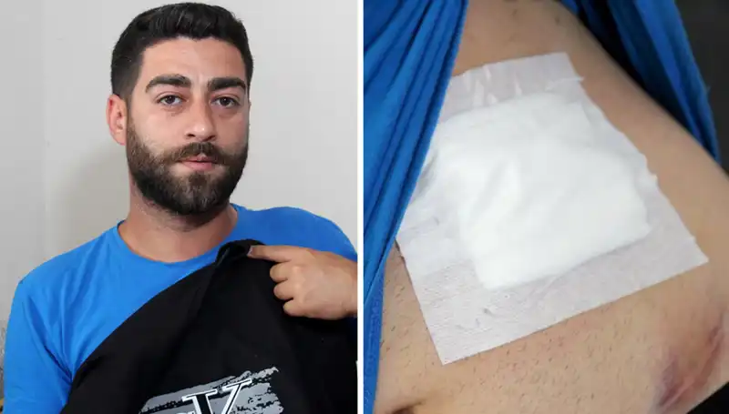 Karnındaki Gizemli Ağrı: Gerçek Röntgende Neler Ortaya Çıktı?