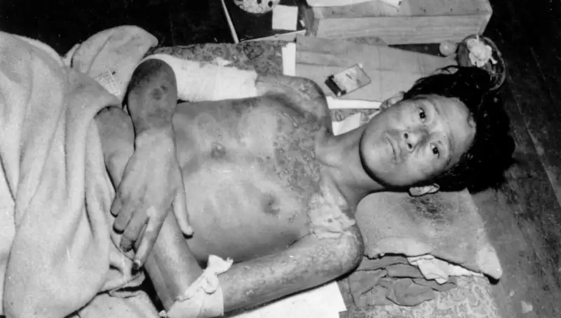 Nükleer Tehditler: Nagasaki'den 80 Yıl Sonra Korkutan Uyarı