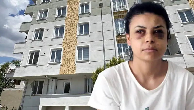 Düğün Fırtınası: Maganda Kurşunuyla Bir Göz Yok Oldu